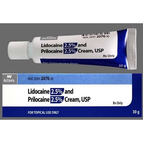 LIDOCAINE PRILOCAINE CREAM 2.5% 30GM